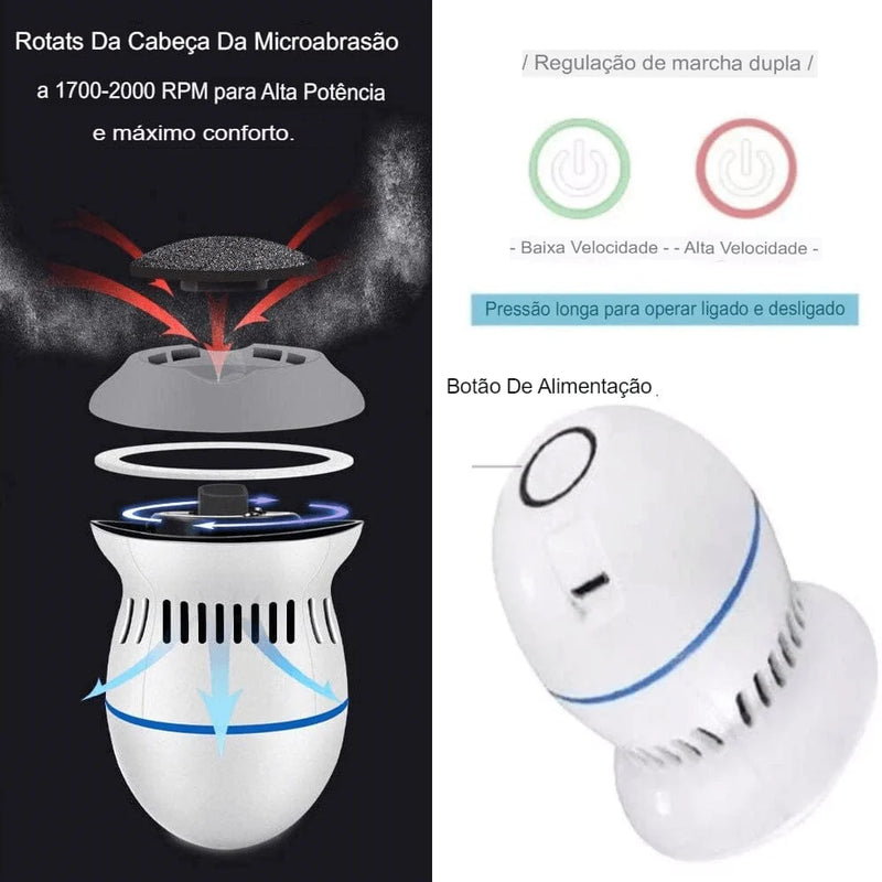 Removedor de Calos Elétrico Portátil - CallusFree
